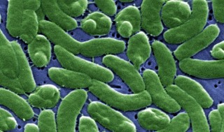 Bakterien Vibrio vulnificuslever i vandmiljøer såsom flodudmundinger, damme og kystnært hav. Infektion af bakterien kan være livsfarlig. Foto: CDC/James Gathany.